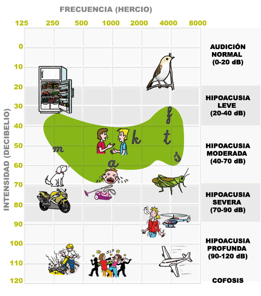 Diccionario de términos sobre la sordera.Resuelve tus dudas sobre el mundo de los sordos con Mi hijo sordo, portal con información de ayuda para padres con hijos sordos.FUNDACIÓN CNSE Y FUNDACIÓN MAPFRE